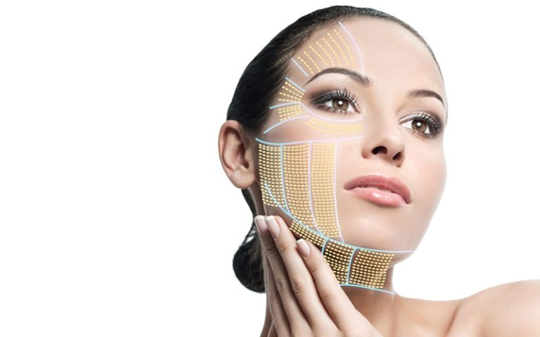 Что такое SMAS лифтинг, в чем его особенности?